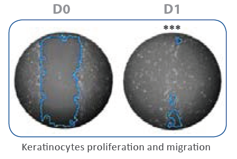 Keratinocytes